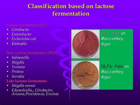 citrobacter freundii lactose fermentation.